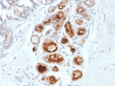 Immunohistochemistry (Formalin/PFA-fixed paraffin-embedded sections) - Anti-Mammaglobin A antibody [MGB1/2000] - BSA and Azide free (AB237862), expandable thumbnail