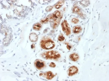 Immunohistochemistry (Formalin/PFA-fixed paraffin-embedded sections) - Anti-Mammaglobin A antibody [MGB1/2000] - BSA and Azide free (AB237862)