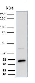 Western blot - Anti-Mammaglobin A antibody [MGB1/2000] - BSA and Azide free (AB237862), expandable thumbnail