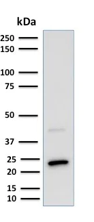 Western blot - Anti-Mammaglobin A antibody [MGB1/2000] - BSA and Azide free (AB237862)