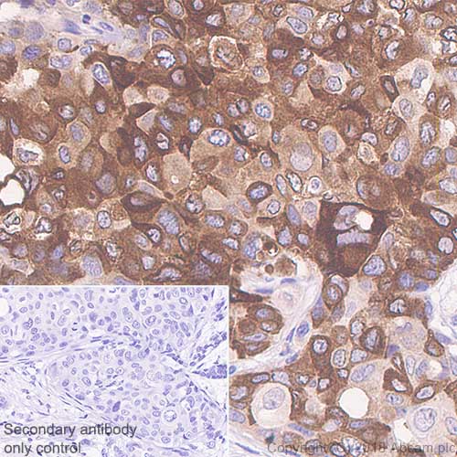 Immunohistochemistry (Formalin/PFA-fixed paraffin-embedded sections) - Anti-Mammaglobin A antibody [SP319] - BSA and Azide free (AB240981)