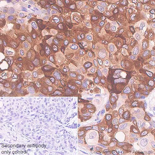 Immunohistochemistry (Formalin/PFA-fixed paraffin-embedded sections) - Anti-Mammaglobin A antibody [SP319] - BSA and Azide free (AB240981)