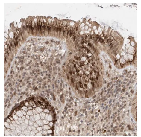 Immunohistochemistry (Formalin/PFA-fixed paraffin-embedded sections) - Anti-MAN1 antibody (AB121854)