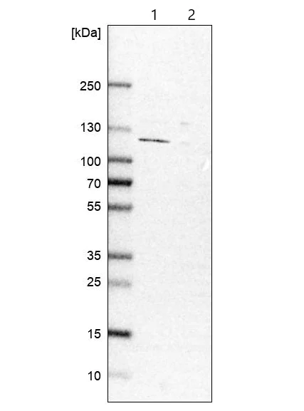 Western blot - Anti-MAN1 antibody (AB121854)
