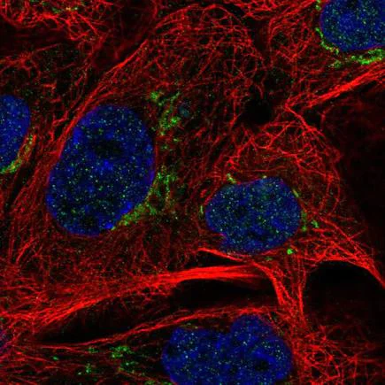 Immunocytochemistry/ Immunofluorescence - Anti-MAN1A2 antibody (AB220865)