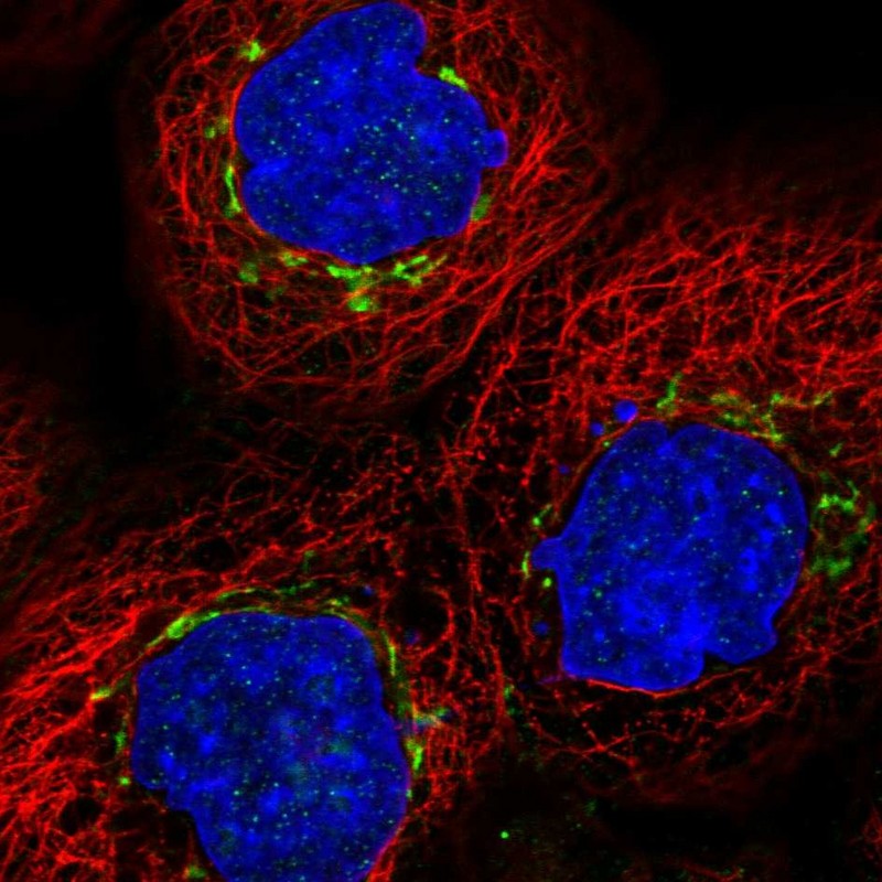 Immunocytochemistry/ Immunofluorescence - Anti-MAN1A2 antibody (AB272611), expandable thumbnail