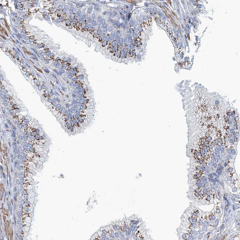 Immunohistochemistry (Formalin/PFA-fixed paraffin-embedded sections) - Anti-MAN1A2 antibody (AB272611)