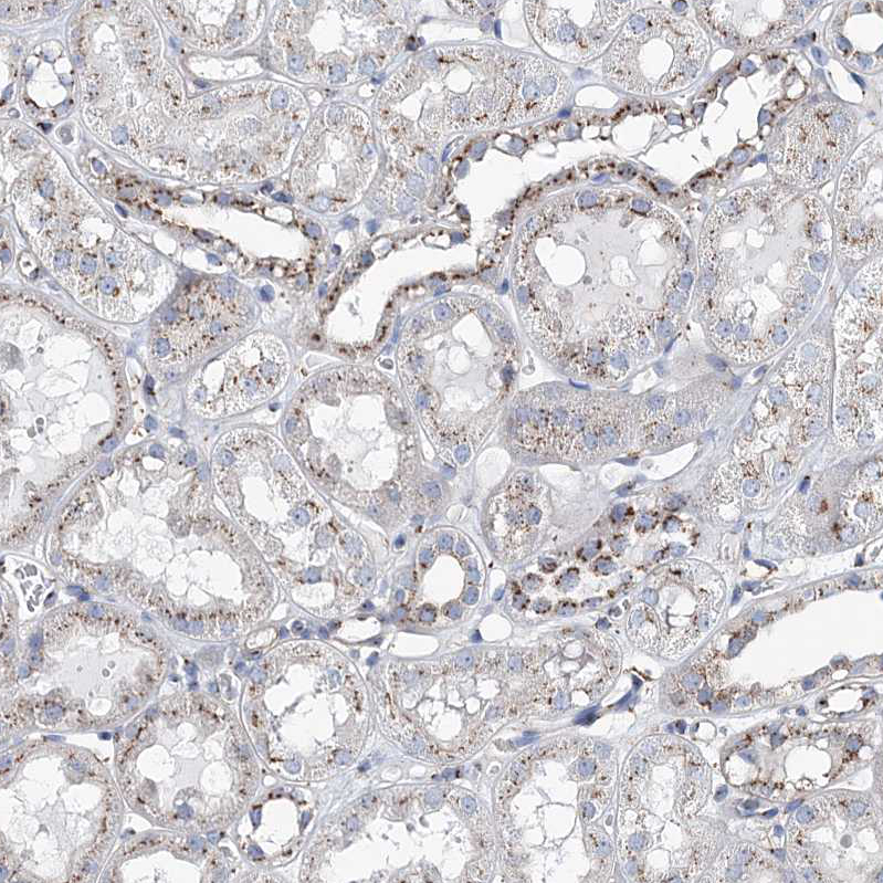 Immunohistochemistry (Formalin/PFA-fixed paraffin-embedded sections) - Anti-MAN1A2 antibody (AB272611), expandable thumbnail