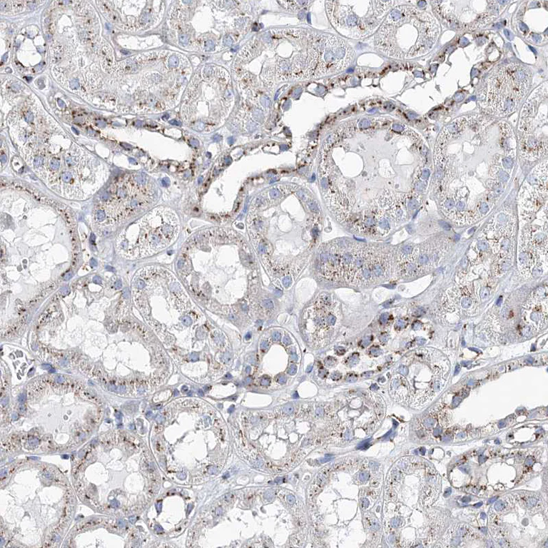 Immunohistochemistry (Formalin/PFA-fixed paraffin-embedded sections) - Anti-MAN1A2 antibody (AB272611)