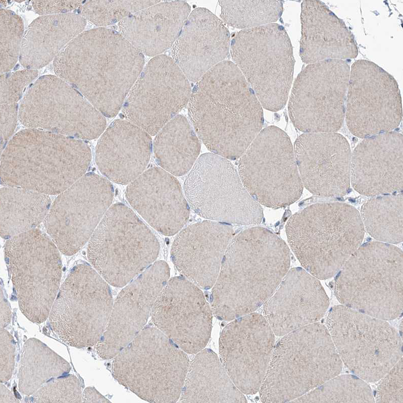 Immunohistochemistry (Formalin/PFA-fixed paraffin-embedded sections) - Anti-MAN1A2 antibody (AB272611), expandable thumbnail