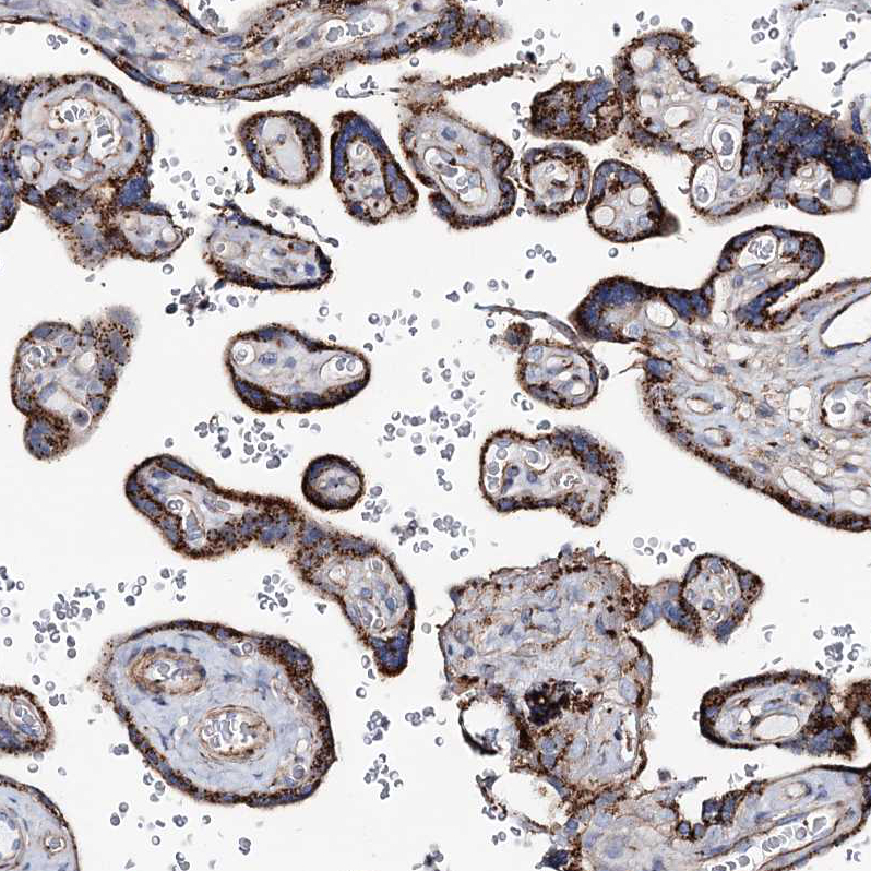 Immunohistochemistry (Formalin/PFA-fixed paraffin-embedded sections) - Anti-MAN1A2 antibody (ab272611), expandable thumbnail