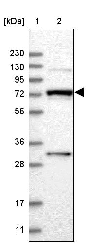 Western blot - Anti-MAN1A2 antibody (AB272611), expandable thumbnail