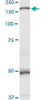 Western blot - Anti-MAN2B1 antibody (AB104521), expandable thumbnail