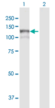 Western blot - Anti-MAN2B1 antibody (AB104521), expandable thumbnail