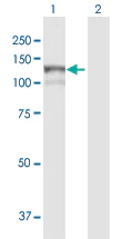 Western blot - Anti-MAN2B1 antibody (AB104521)