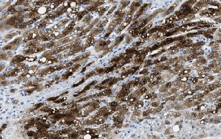 Immunohistochemistry (Formalin/PFA-fixed paraffin-embedded sections) - Anti-Mannan Binding Lectin/MBL antibody [3B6] (AB23457)
