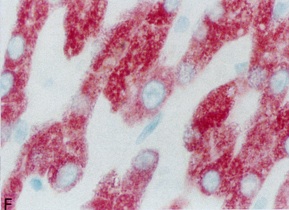 Immunohistochemistry (Formalin/PFA-fixed paraffin-embedded sections) - Anti-Mannan Binding Lectin/MBL antibody [3B6] (AB23457)