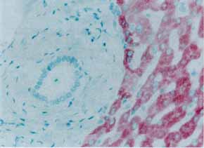 Immunohistochemistry (Formalin/PFA-fixed paraffin-embedded sections) - Anti-Mannan Binding Lectin/MBL antibody [3B6] (AB23457), expandable thumbnail