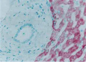 Immunohistochemistry (Formalin/PFA-fixed paraffin-embedded sections) - Anti-Mannan Binding Lectin/MBL antibody [3B6] (AB23457)