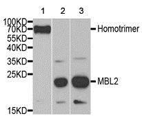 Western blot - Anti-Mannan Binding Lectin/MBL antibody (AB189856)