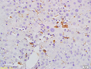 Immunohistochemistry (Formalin/PFA-fixed paraffin-embedded sections) - Anti-Mannan Binding Lectin/MBL antibody (AB203303), expandable thumbnail