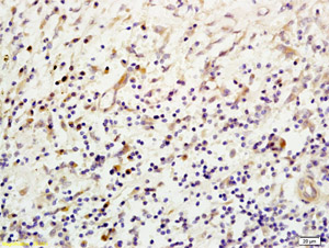 Immunohistochemistry (Formalin/PFA-fixed paraffin-embedded sections) - Anti-Mannan Binding Lectin/MBL antibody (AB203303), expandable thumbnail