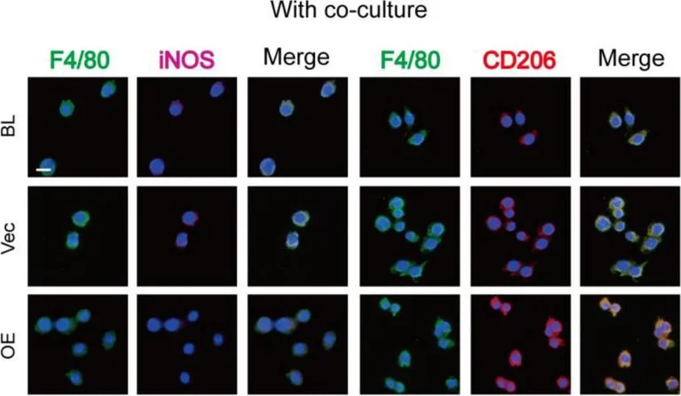 Immunocytochemistry - Anti-Mannose Receptor antibody (AB64693)