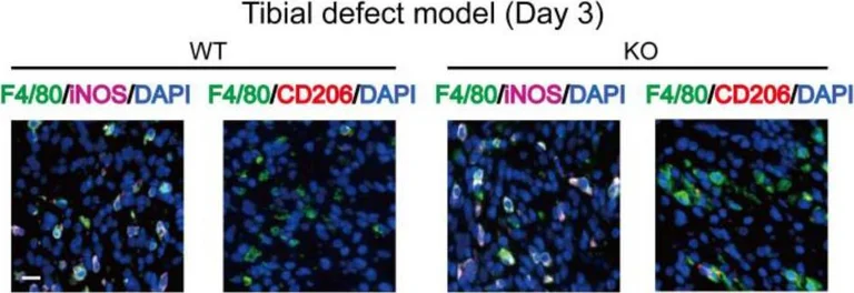 Immunocytochemistry - Anti-Mannose Receptor antibody (AB64693)