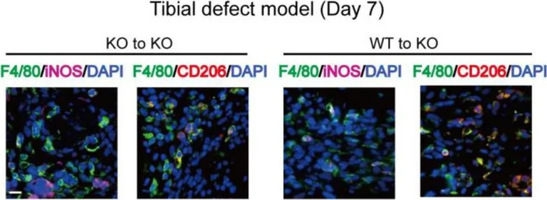 Immunocytochemistry - Anti-Mannose Receptor antibody (AB64693)