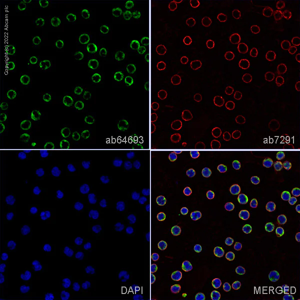 Immunocytochemistry/ Immunofluorescence - Anti-Mannose Receptor antibody (AB64693)