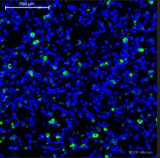 Immunohistochemistry (Formalin/PFA-fixed paraffin-embedded sections) - Anti-Mannose Receptor antibody (AB64693)