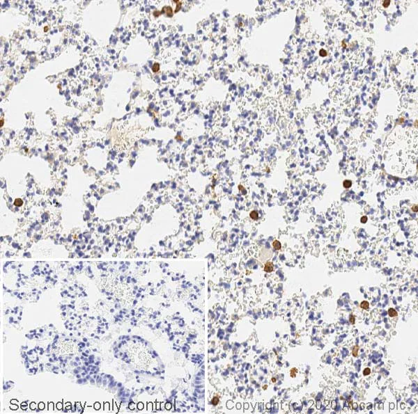 Immunohistochemistry (Formalin/PFA-fixed paraffin-embedded sections) - Anti-Mannose Receptor antibody (AB64693)