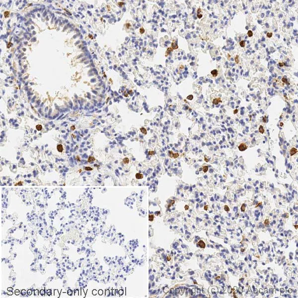 Immunohistochemistry (Formalin/PFA-fixed paraffin-embedded sections) - Anti-Mannose Receptor antibody (AB64693)