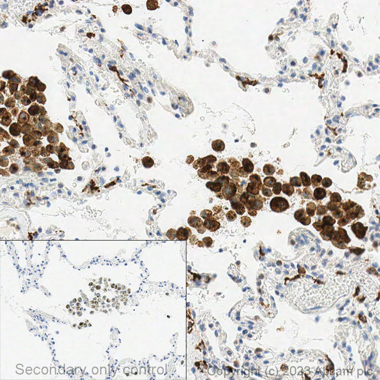 Immunohistochemistry (Formalin/PFA-fixed paraffin-embedded sections) - Anti-Mannose Receptor antibody (AB64693)