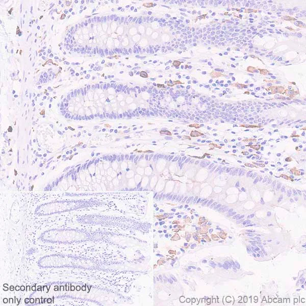 Immunohistochemistry (Formalin/PFA-fixed paraffin-embedded sections) - Anti-Mannose Receptor antibody [EPR22489-7] (AB252921)