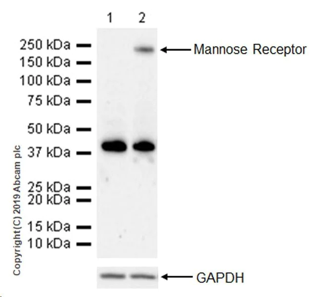 Western blot - Anti-Mannose Receptor antibody [EPR22489-7] (AB252921)
