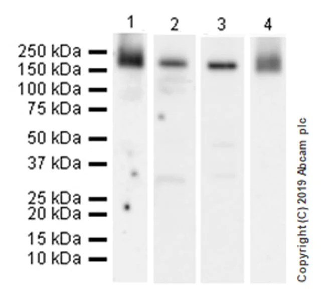 Western blot - Anti-Mannose Receptor antibody [EPR22489-7] (AB252921)