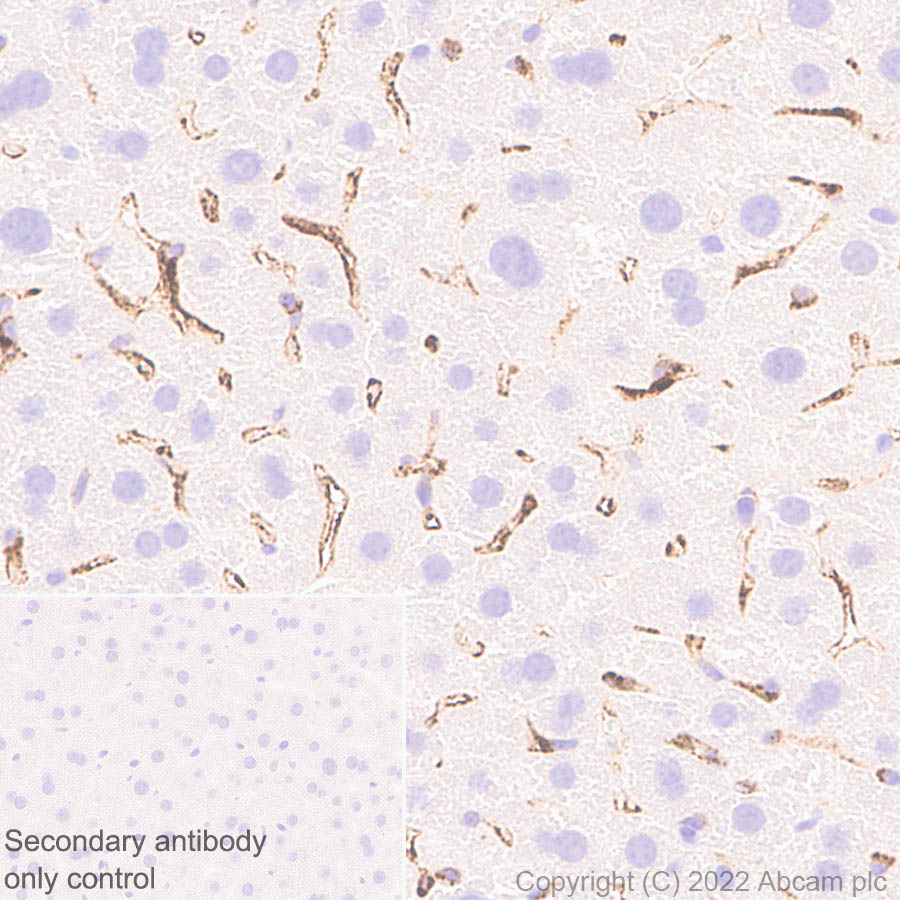 Immunohistochemistry (Formalin/PFA-fixed paraffin-embedded sections) - Anti-Mannose Receptor antibody [EPR25215-277] (AB300621), expandable thumbnail