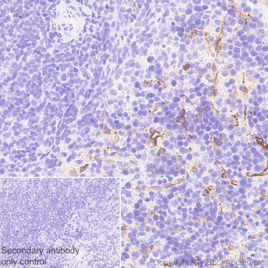 Immunohistochemistry (Formalin/PFA-fixed paraffin-embedded sections) - Anti-Mannose Receptor antibody [EPR25215-277] (AB300621), expandable thumbnail