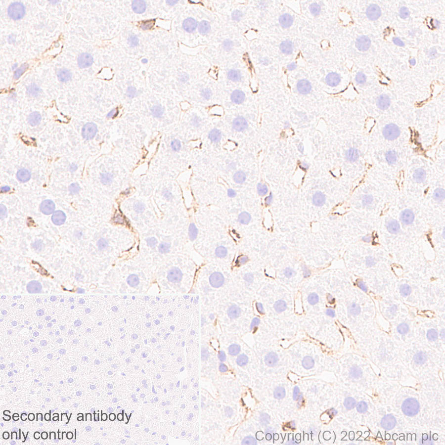 Immunohistochemistry (Formalin/PFA-fixed paraffin-embedded sections) - Anti-Mannose Receptor antibody [EPR25215-277] (ab300621), expandable thumbnail