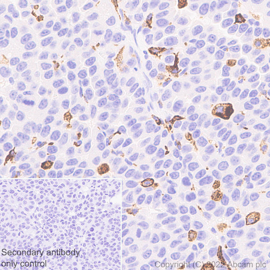 Immunohistochemistry (Formalin/PFA-fixed paraffin-embedded sections) - Anti-Mannose Receptor antibody [EPR25215-277] (ab300621), expandable thumbnail