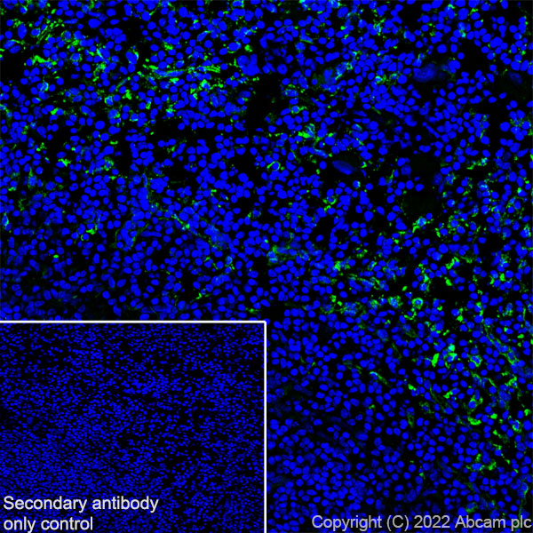 Immunohistochemistry (Frozen sections) - Anti-Mannose Receptor antibody [EPR25215-277] (ab300621), expandable thumbnail