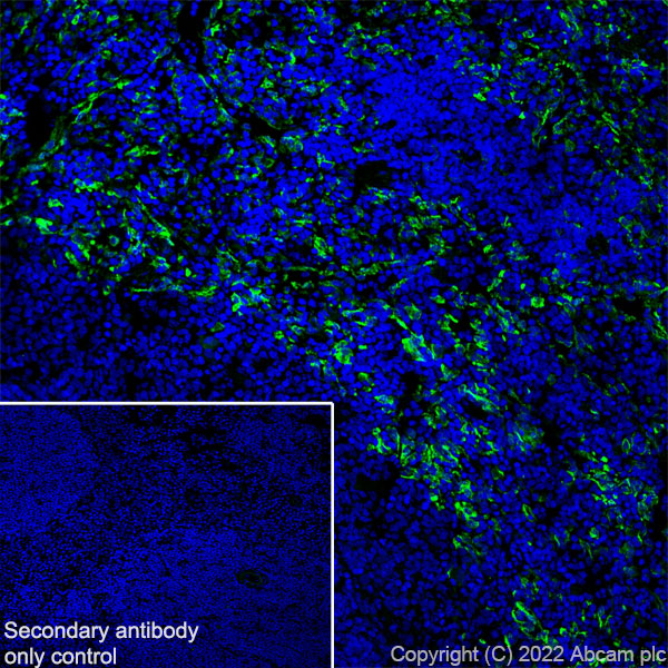 Immunohistochemistry (Frozen sections) - Anti-Mannose Receptor antibody [EPR25215-277] (ab300621), expandable thumbnail