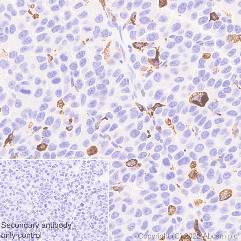 Immunohistochemistry (Formalin/PFA-fixed paraffin-embedded sections) - Anti-Mannose Receptor antibody [EPR25215-277] - BSA and Azide free (AB300622)