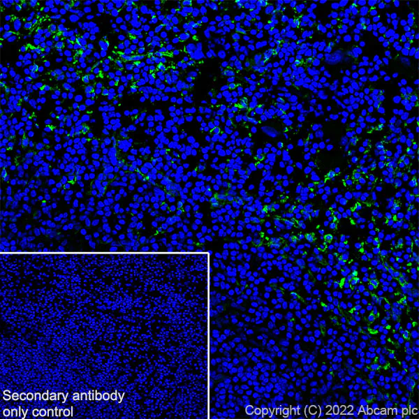 Immunohistochemistry (Frozen sections) - Anti-Mannose Receptor antibody [EPR25215-277] - BSA and Azide free (AB300622)