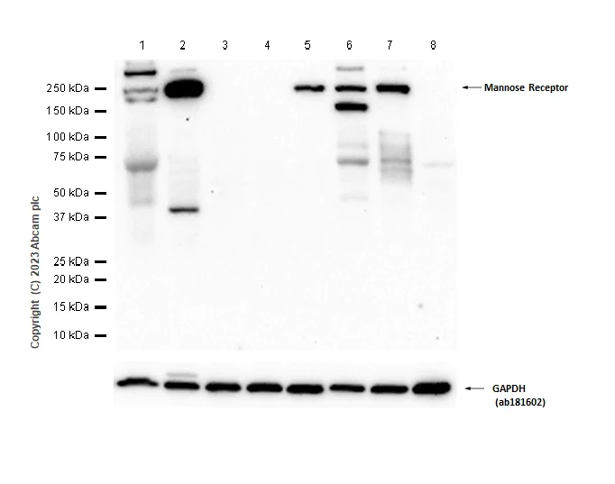 Western blot - Anti-Mannose Receptor antibody [EPR25215-277] - BSA and Azide free (AB300622)