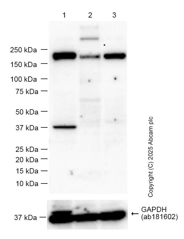 Western blot - Anti-Mannose Receptor antibody [EPR25215-277] - BSA and Azide free (AB300622)