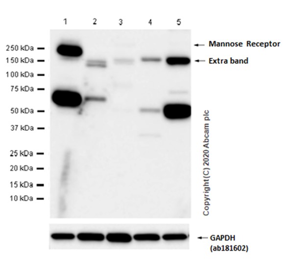 Western blot - Anti-Mannose Receptor antibody [EPR6828(B)] (AB125028), expandable thumbnail