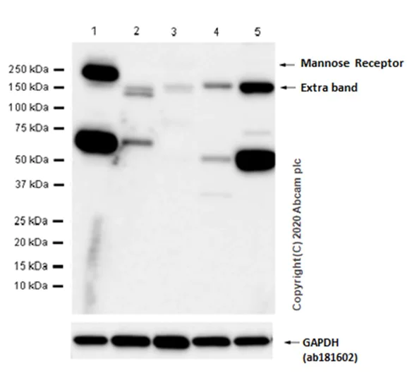 Western blot - Anti-Mannose Receptor antibody [EPR6828(B)] - BSA and Azide free (AB209332)