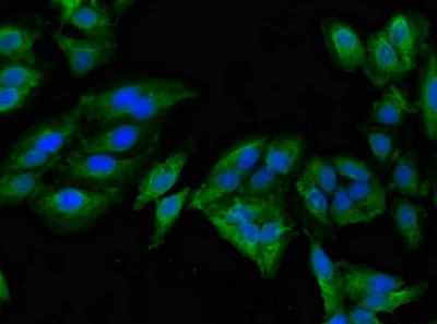 Immunocytochemistry/ Immunofluorescence - Anti-Mannosidase II/MAN2A1 antibody (AB224611)